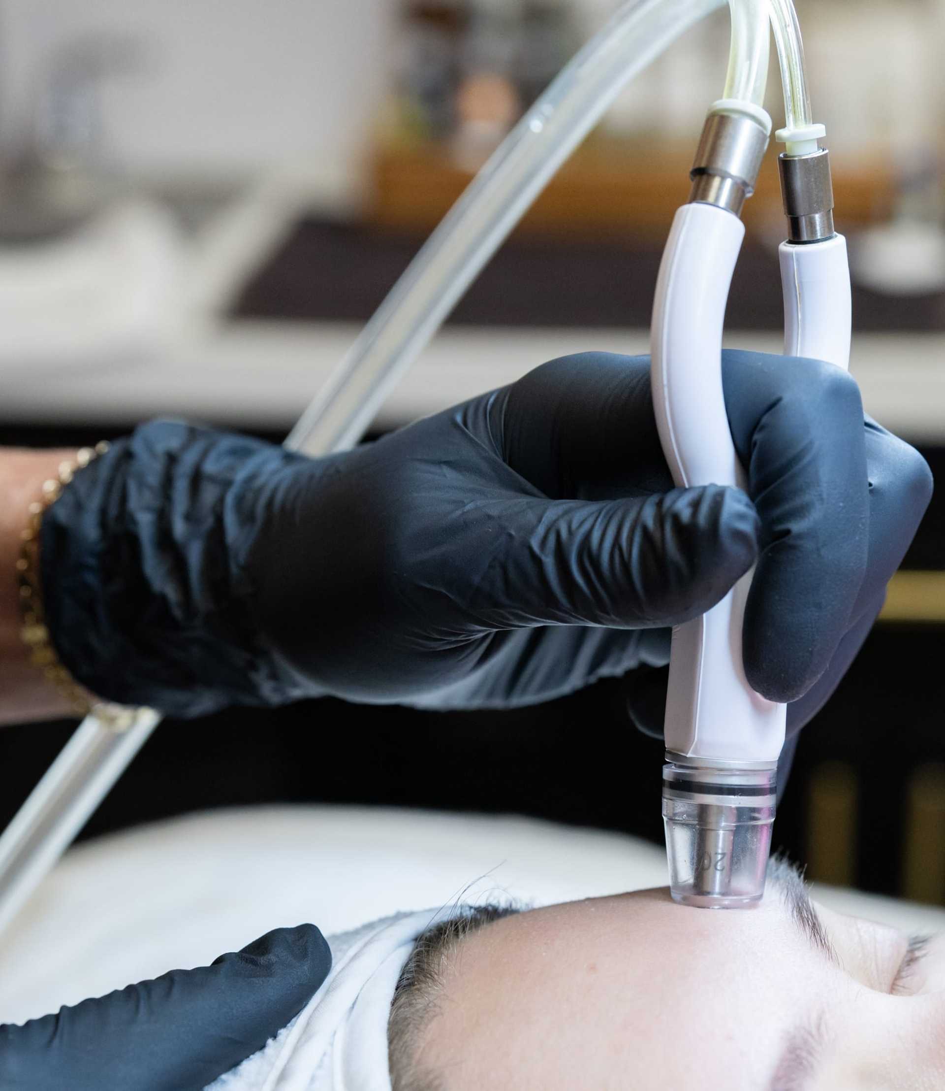 Gloved hand performing a facial treatment with a dermabrasion device on a person's skin.